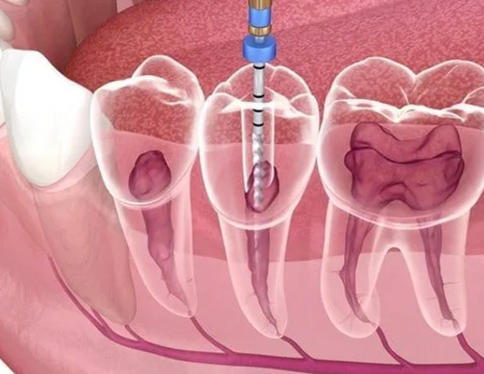 Dental Reconstruction
