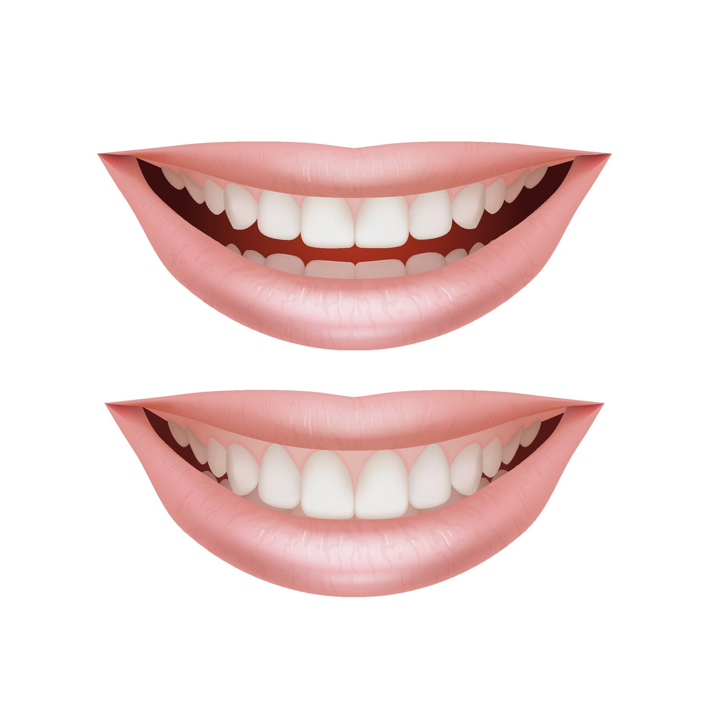 Full Arch Mouth Rehabilitation