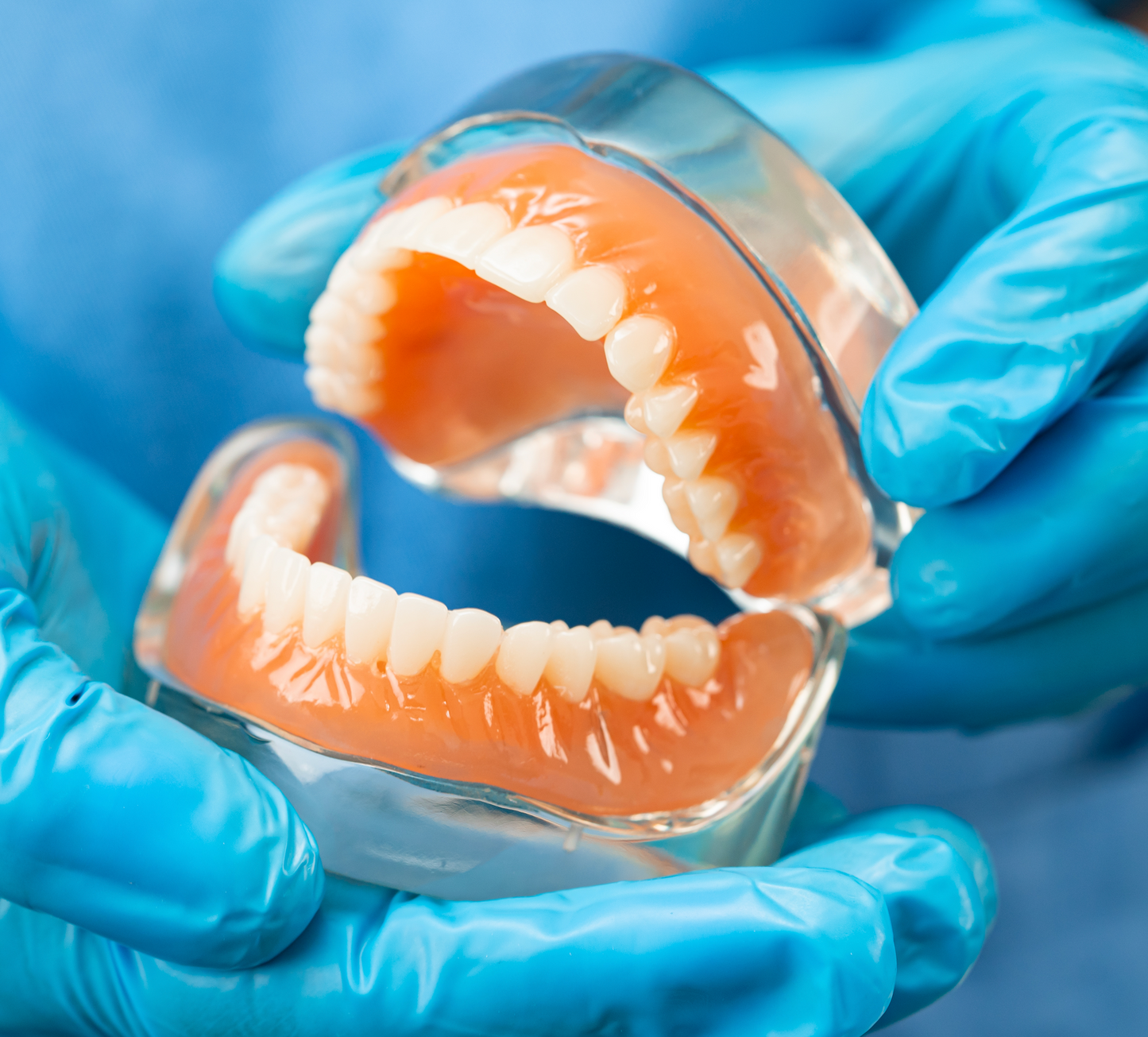 Complete Removable Denture