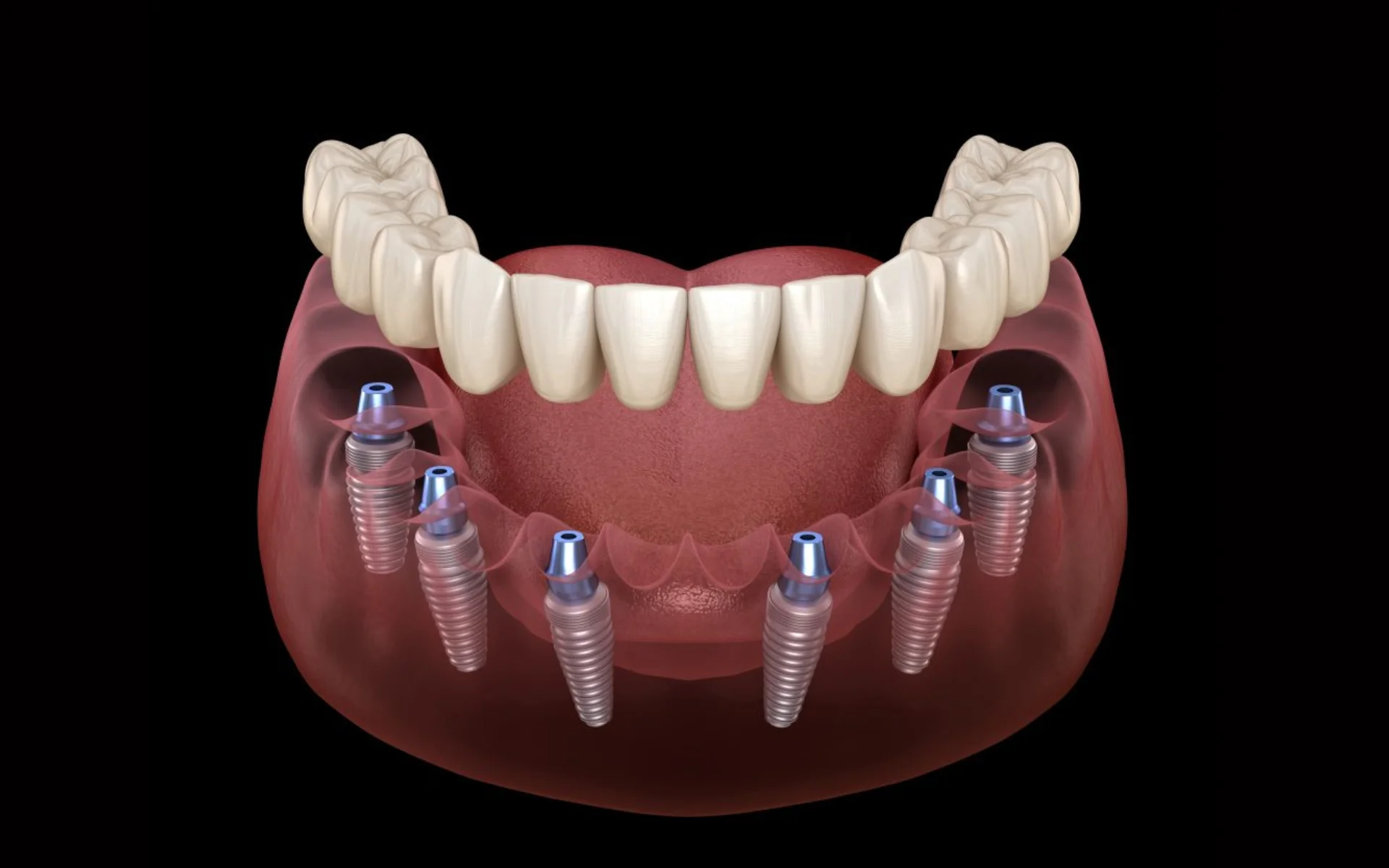 ALL-ON-6 – Tre.M – Macerata (IT)