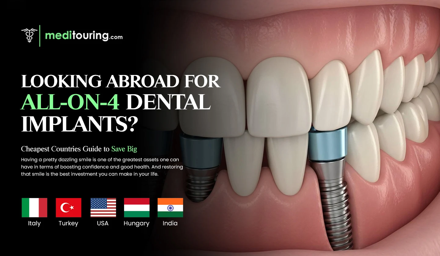 All-on-4 Dental Implants