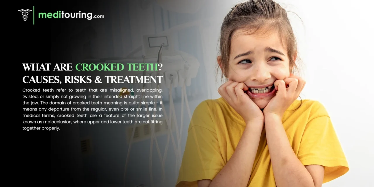 What Are Crooked Teeth? Causes, Risks & Treatment