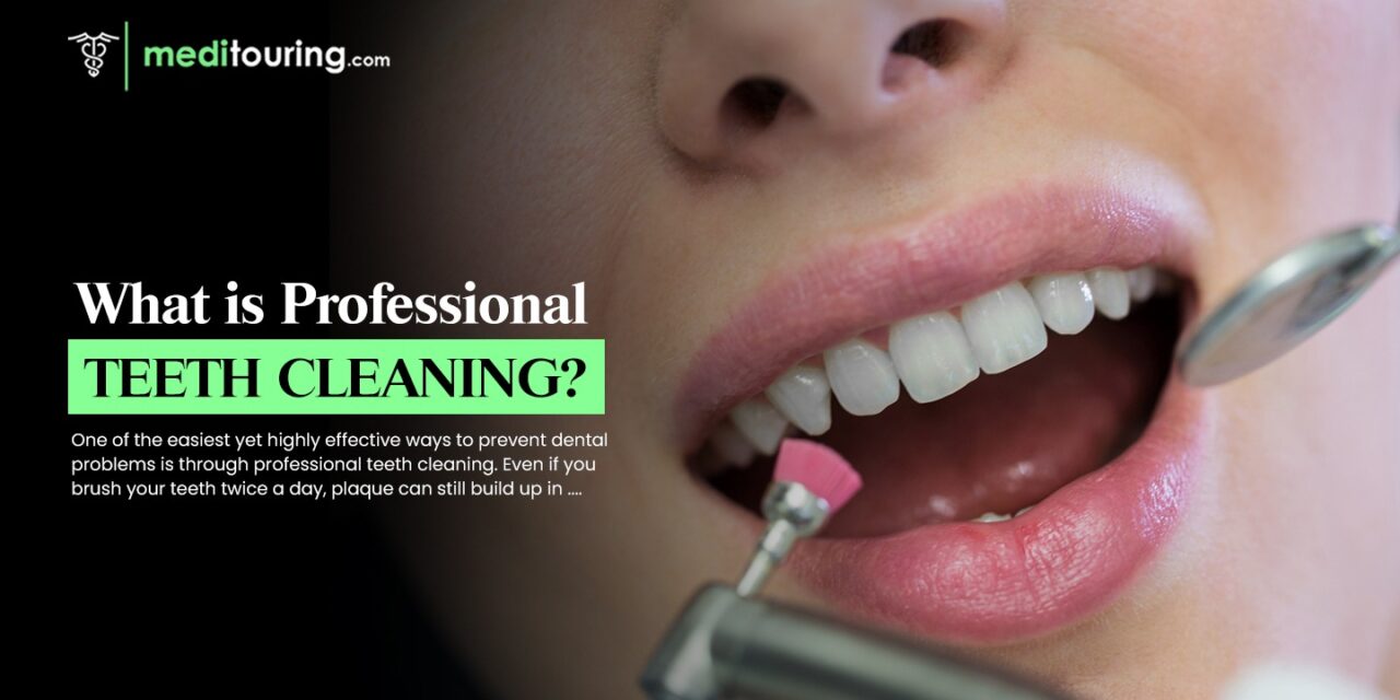 What Is Professional Teeth Cleaning?