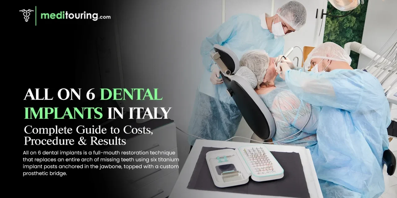 All on 6 Dental Implants in Italy: Complete Guide to Costs, Procedure & Results
