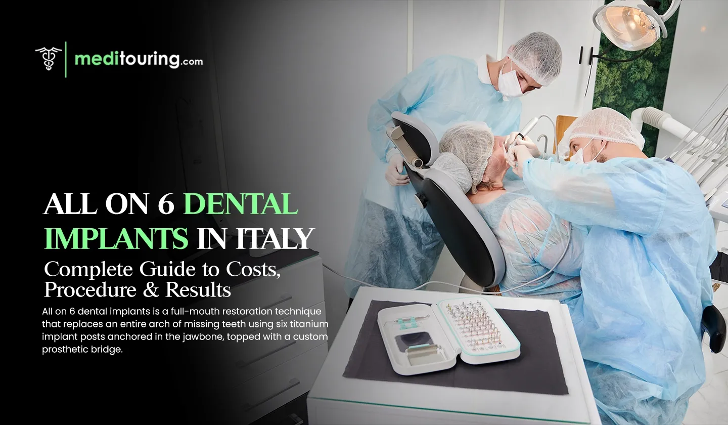 all on 6 dental implants in italy