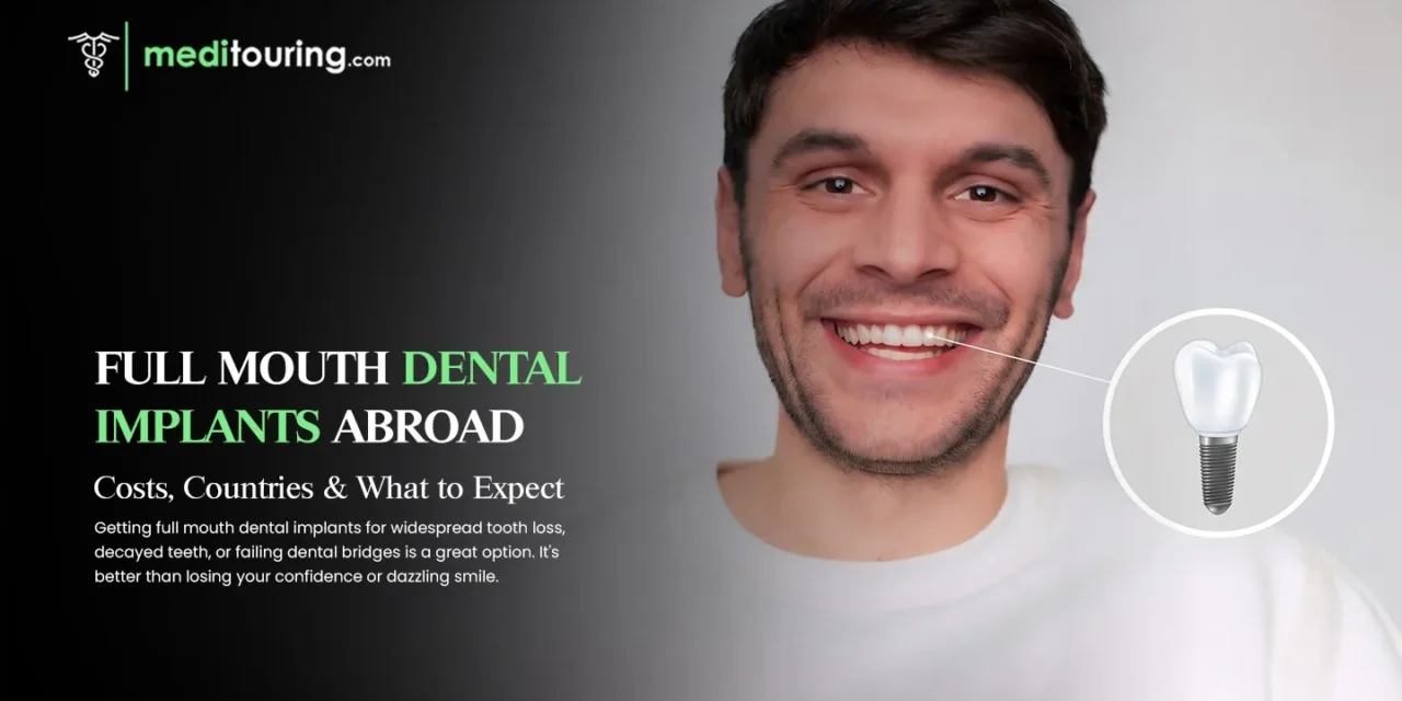 Full Mouth Dental Implants Abroad: Costs, Countries & What to Expect