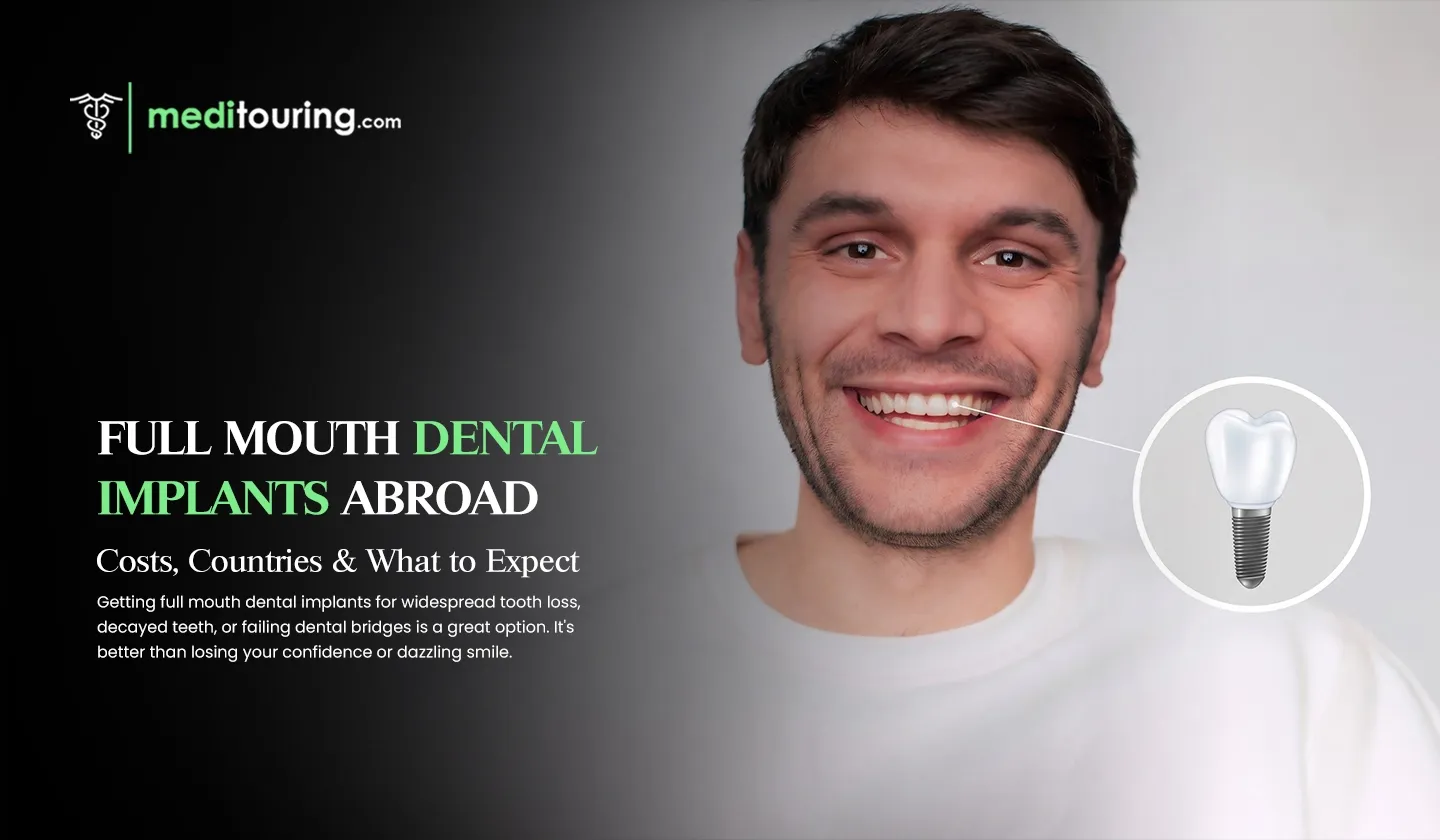 full mouth dental implants abroad