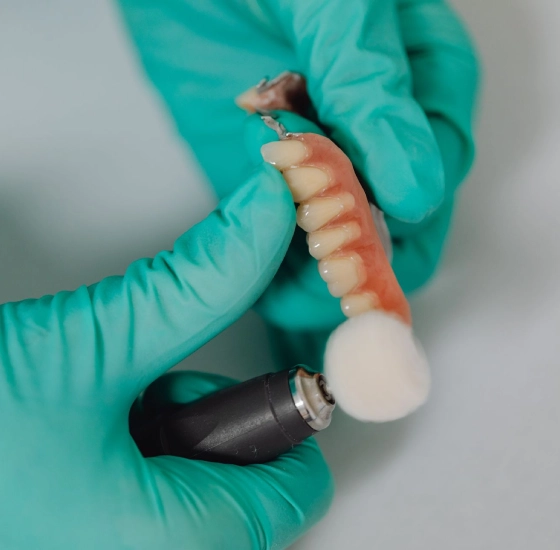 dental implants dental implants