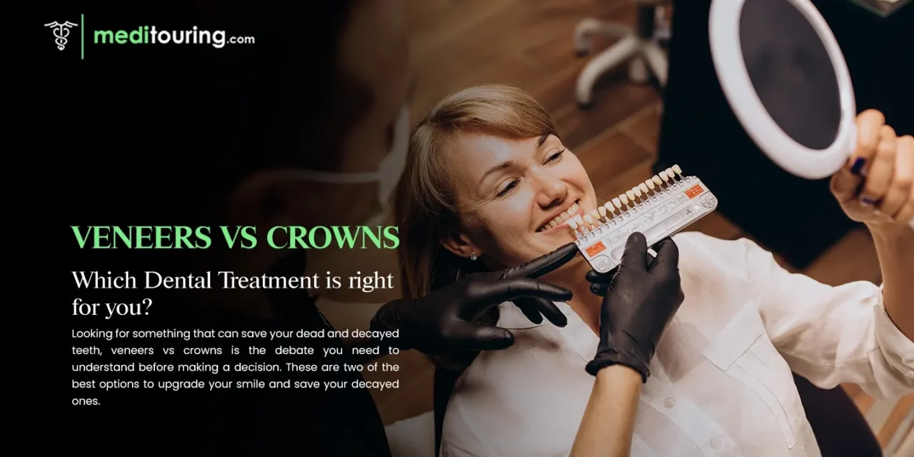 Veneers vs Crowns: Which Dental Treatment Is Right for You?