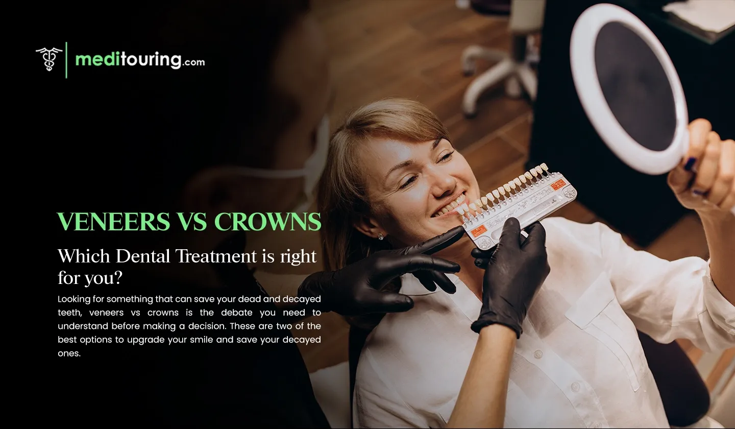 veneers vs crowns