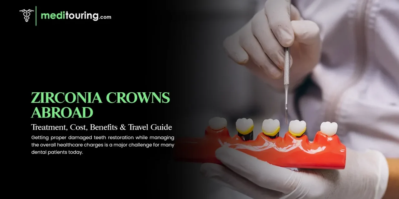 Zirconia Crowns Abroad: Treatment, Cost, Benefits & Travel Guide